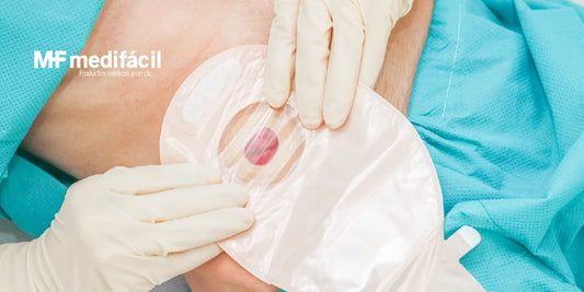 Las preocupaciones del ostomizado