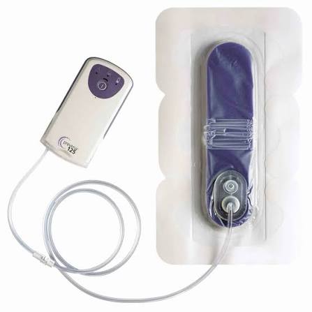 Solventum PRE1001US STRAC PREVENA KIT