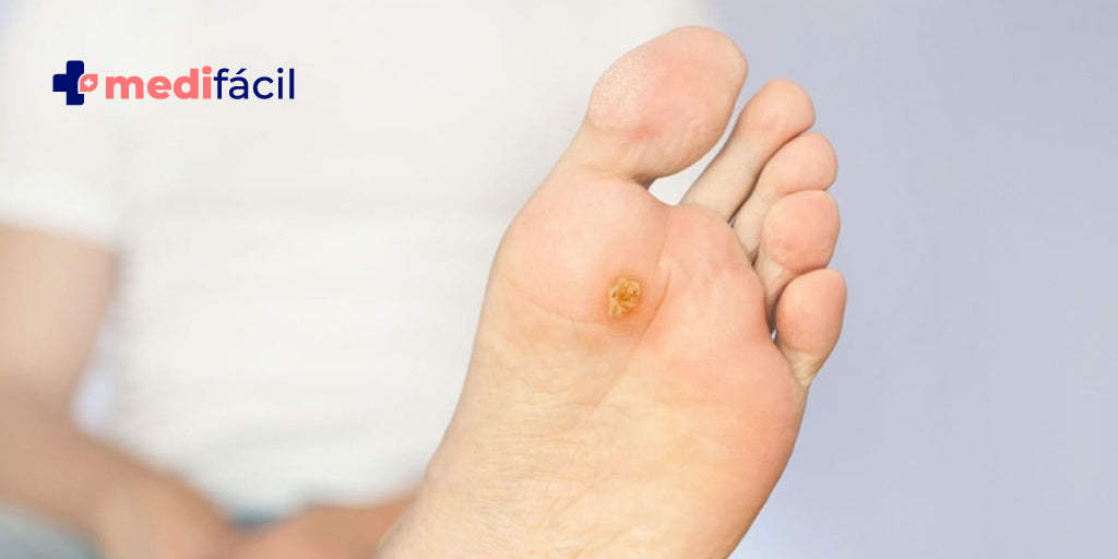 Complicaciones del pie diabético