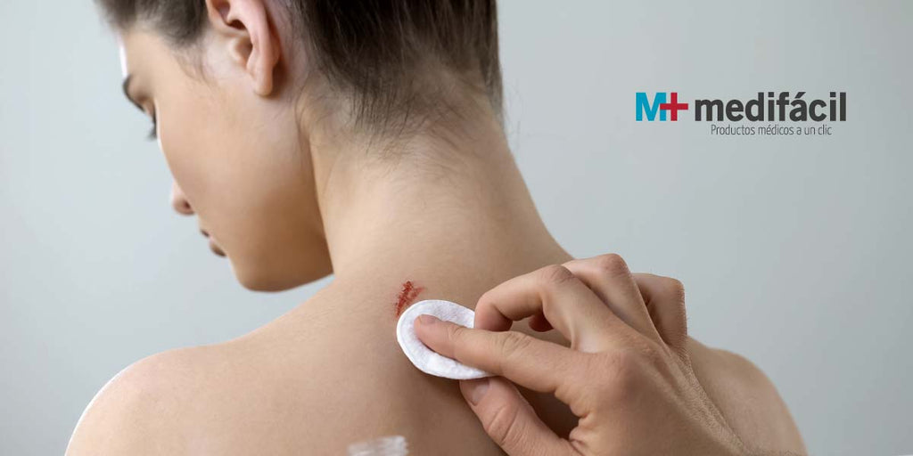 Heridas más comunes en la piel