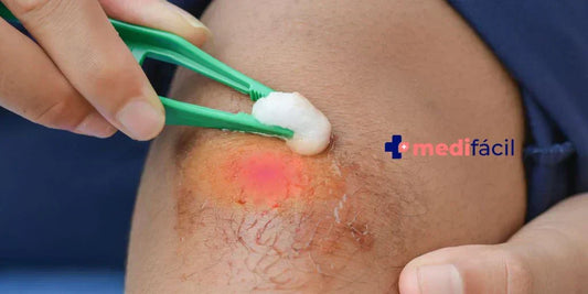 Biofilm o Biopelículas: Aprende a Manejar este Enemigo Invisible en las Heridas